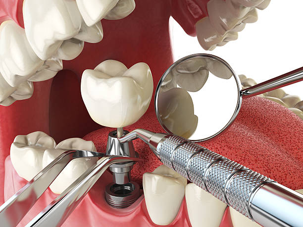 Best Urgent Tooth Repair  in Gautier, MS